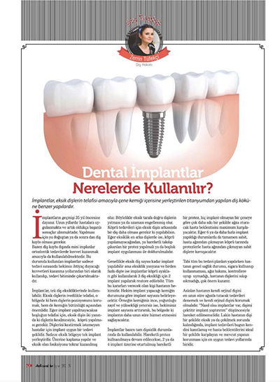 Zerrin Tüfekçi - Dental İmplantlar Nerelerde Kullanılır?