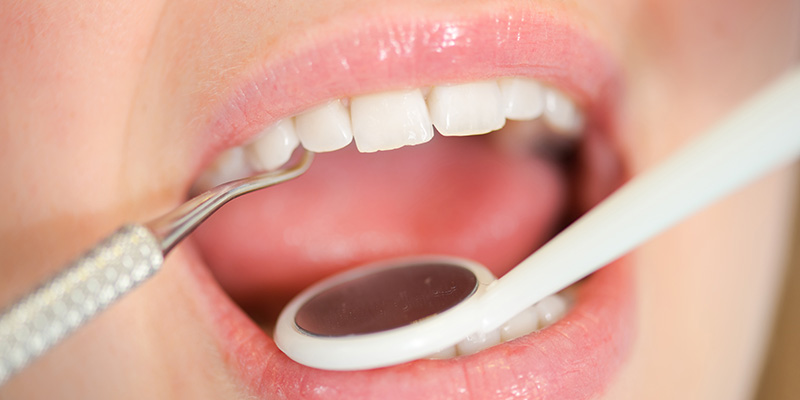Restoratif Diş Tedavileri