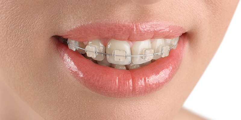 Ortodontik Tedavi Yaşı