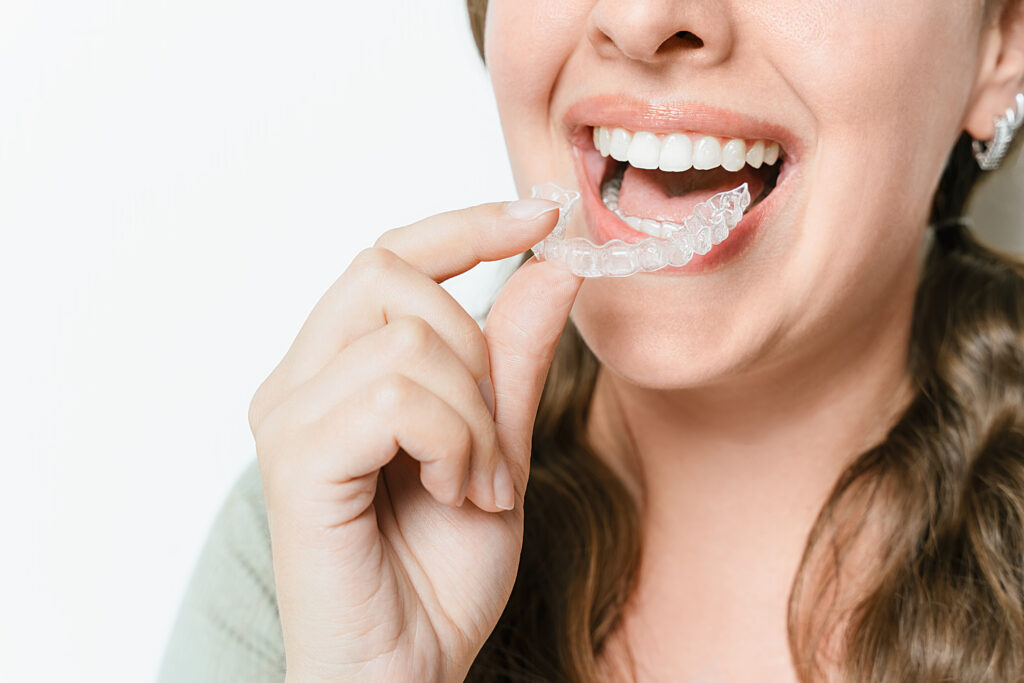 Woman Inserting Clear Teeth Aligner.jpg
